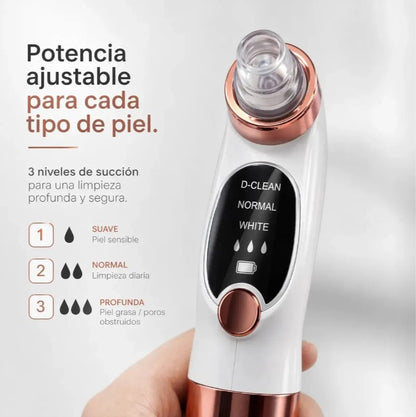 Extractor De Puntos Negros (REF. 56321)