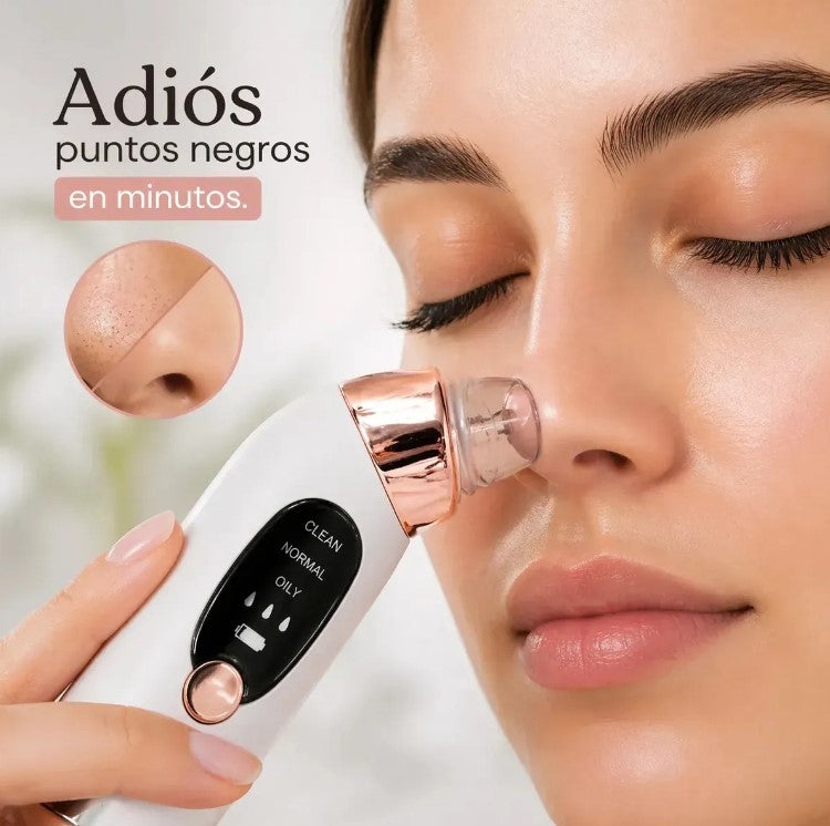 Extractor De Puntos Negros (REF. 56321)
